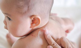 Ngăn ngừa, giảm nhẹ nhiễm trùng eczema ở trẻ