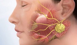 Phân biệt ung thư vòm họng với bệnh lý vùng mũi họng