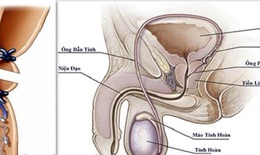 Thắt ống dẫn tinh - Biện pháp tránh thai hiệu quả, ít rủi ro