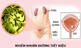 Nhận biết, phòng ngừa nhiễm trùng tiết niệu