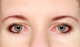 4 triệu chứng ở mắt không nên bỏ qua