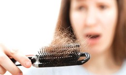 Nguyên nhân khiến tóc rụng từng búi vào mùa đông