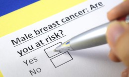 Yếu tố nguy cơ gây ung thư vú ở nam giới