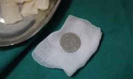 Bé trai hóc đồng xu khi đùa nghịch, bác sĩ chỉ cách sơ cứu cần làm ngay