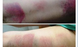 Giáo viên chủ nhiệm bị tố đánh 22 học sinh ở Vũng Tàu, Bộ Giáo dục nói gì?