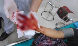 Một thanh niên bị máy làm mộc nghiền nát bàn tay phải, đứt lìa 3 ngón tay