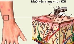 Ngừa biến chứng nguy hiểm của sốt xuất huyết