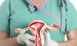 3 chị em ruột cùng mắc ung thư buồng trứng, bác sĩ khuyên cần làm điều này để phát hiện sớm