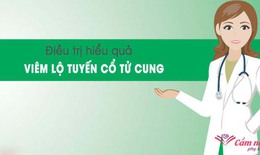 Viêm lộ tuyến cổ tử cung và cách điều trị hiệu quả nhất
