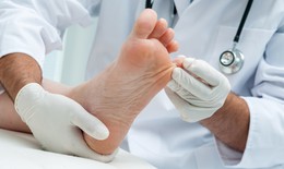Biến chứng tiểu đường: Vết xước nhỏ cũng có thể phải đoạn chi