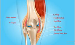 Phòng ngừa thoái hóa khớp ngay từ khi còn trẻ