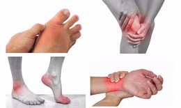 Giải pháp hữu hiệu đẩy lùi biến chứng bệnh viêm khớp