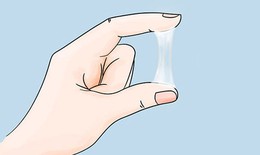 Huyết trắng bất thường: Biểu hiện, nguyên nhân và cách xử lý hiệu quả