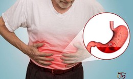 Đẩy lùi xuất huyết dạ dày hiệu quả nhờ sản phẩm Đông y