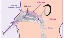 Phương pháp rửa mũi mới - bước tiến mới trong phòng chống bệnh đường hô hấp ở trẻ