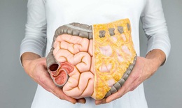 Công nghệ NBI mới giúp phát hiện sớm ung thư tiêu hóa