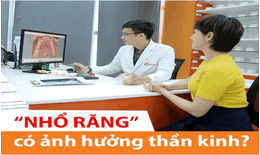 Giải mã nghi vấn: “Nhổ răng có ảnh hưởng thần kinh”