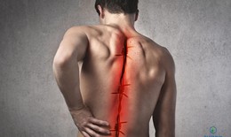 6 triệu chứng gai cột sống dễ nhận biết