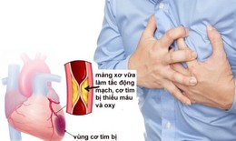Xét nghiệm định kỳ tại nhà - bí quyết giúp bạn sống khỏe với bệnh mạn tính