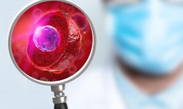 Tăng cường hệ miễn dịch theo phương pháp Nhật Bản