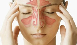 Người viêm mũi xoang thì phòng nhiễm COVID-19 như thế nào?