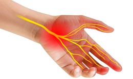 Tê ngón tay, bàn tay là do hội chứng ống cổ tay – Cách nhận biết và biện pháp khắc phục