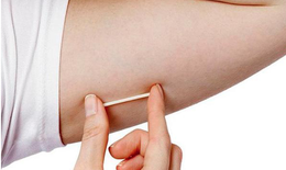 Miễn phí khám cấy que tránh thai: Chỉ làm 1 lần - hiệu quả 3 năm