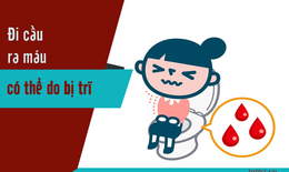 Giảm nhanh chảy m&#225;u trong bệnh trĩ