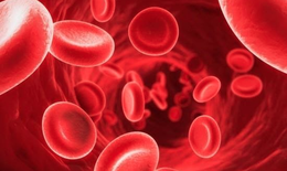 Thiếu máu do thiếu sắt ở tuổi 50+ và tác hại đối với cơ thể