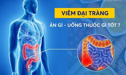 Viêm đại tràng là gì? Nguyên nhân, triệu chứng, cách điều trị