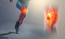 Giải pháp tối ưu hỗ trợ khớp khoẻ mạnh, hạn chế thoái hoá