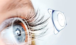 Phakic ICL - Phương ph&#225;p hiệu quả trong điều trị cận thị