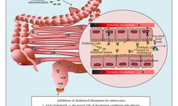 Lactobacillus plantarum hỗ trợ giảm mỡ m&#225;u, giảm nguy cơ xơ vữa động mạch