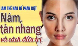 C&#225;ch ph&#226;n biệt n&#225;m, t&#224;n nhang, đồi mồi v&#224; c&#225;ch điều trị hiệu quả