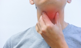Nguyên nhân chủ yếu của đau họng là do virus, vi khuẩn gây viêm họng