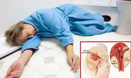 Infographic: Bị mỡ máu cao để lâu gây nguy hiểm tính mạng, 7 điều nên làm ngay!