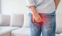 Đau rát, chảy máu tái phát nhiều do trĩ cấp và biện pháp cải thiện