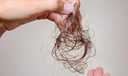 Rụng tóc sau sinh và cách khắc phục từ dầu gội gừng hữu cơ