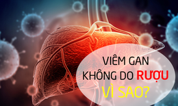 Viêm gan không do rượu: Nguyên nhân và biện pháp cải thiện