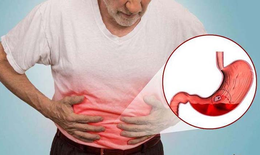 Đau dạ dày là gì? Dấu hiệu, nguyên nhân và các biến chứng?
