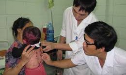 Hà Nội: Xuất hiện 4 ổ dịch thuỷ đậu tại trường tiểu học và liên cấp