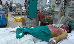 Tự mua thuốc điều trị thủy đậu, nam thanh niên 28 tuổi nguy kịch