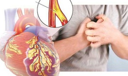 31% số trường hợp tử vong trên toàn quốc liên quan bệnh tim mạch