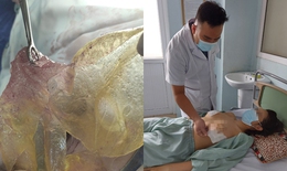 Người phụ nữ ở Hà Nội bị vỡ túi silicon sau 6 năm nâng ngực