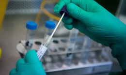 Bộ Y tế: Danh sách các sản phẩm, thiết bị y tế chẩn đoán xét nghiệm virus SARS-CoV-2 đã cấp số đăng ký