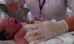 Quảng Nam: Cứu sống trẻ sơ sinh bị thắt nút dây rốn