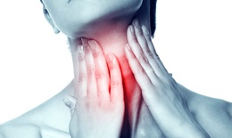 10 cách làm giảm đau họng