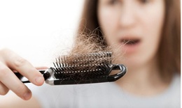 Giải pháp cho một mái tóc khỏe đẹp