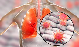 5 căn bệnh gây tử vong cao nhất và cách phòng chống