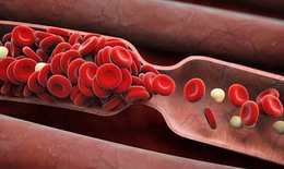 Cảnh giác xuất huyết khi dùng thuốc